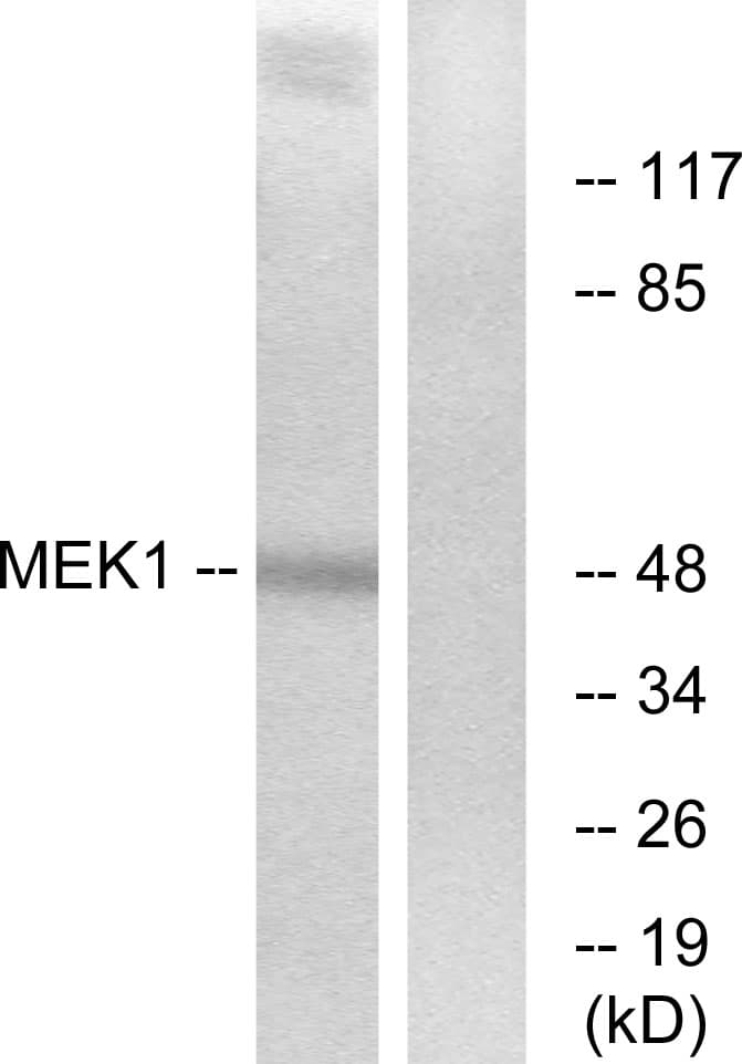 Polyclonal Rabbit anti-Human MEK1 + MEK2 Antibody (aa193-242, IHC, WB)