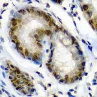 PSME2 Antibody