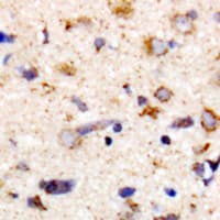 Polyclonal Rabbit anti-Human PPP1R12A / MYPT1 Antibody (phospho-Thr853, IHC, WB)