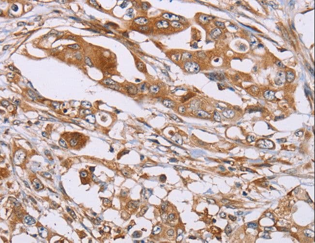 OS9 Antibody