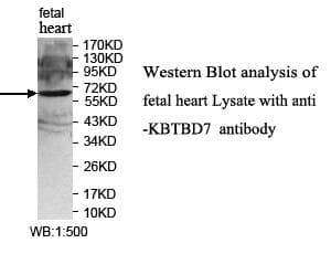 KBTBD7 Antibody (aa311-474)