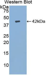 IGF1 Antibody (aa53-132)