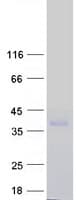 Human CD99L2 Protein (Recombinant Myc-DDK (Flag))