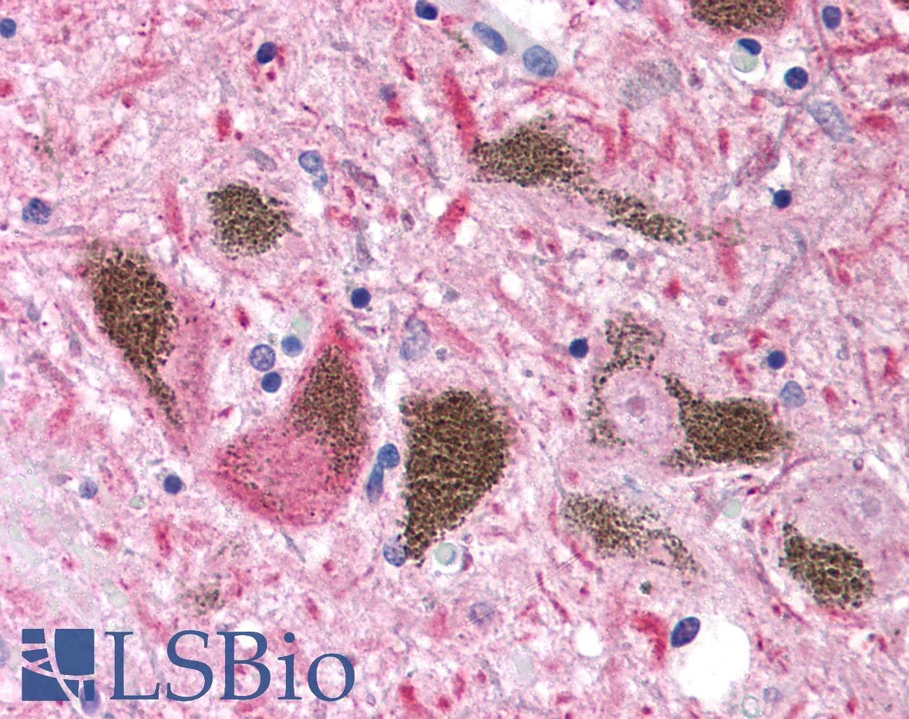 UCHL1 / PGP9.5 Antibody (Internal, Biotin)