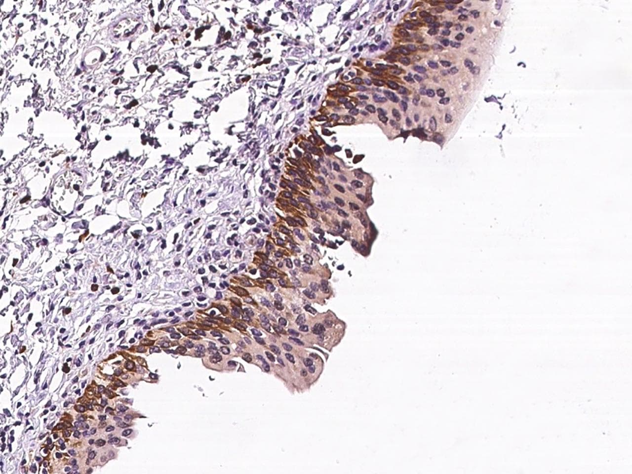 ADGRE3 / EMR3 Antibody