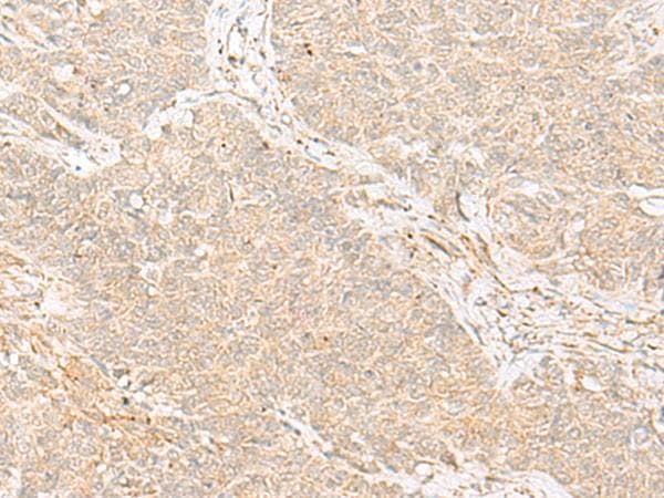 Polyclonal Rabbit anti-Human TRAF6 Antibody (IHC, WB)