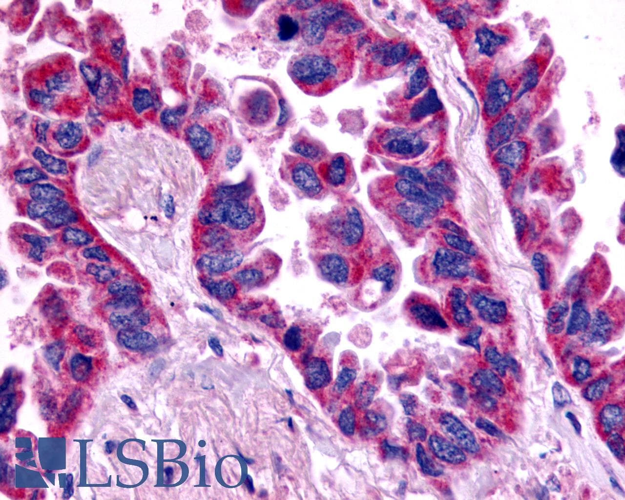 PathPlus™ EDNRA / Endothelin A Receptor Antibody (Extracellular Domain)