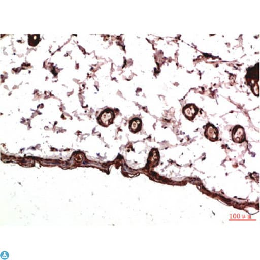 PDGFRA / PDGFR Alpha Antibody