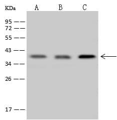 CDK20 / CCRK Antibody