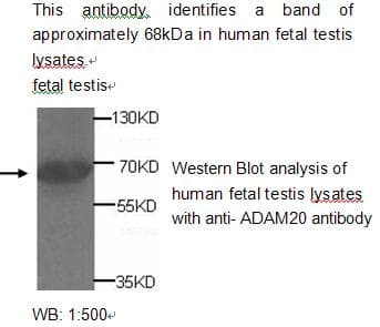 ADAM20 Antibody