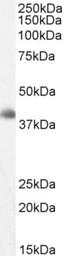IHC-plus™ DKK3 Antibody (aa340-350)