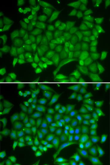 Polyclonal Rabbit anti-Human RAB11A Antibody (IHC, IF, WB)