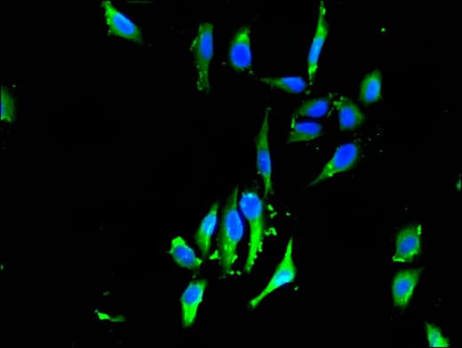 SLIM / FHL1 Antibody