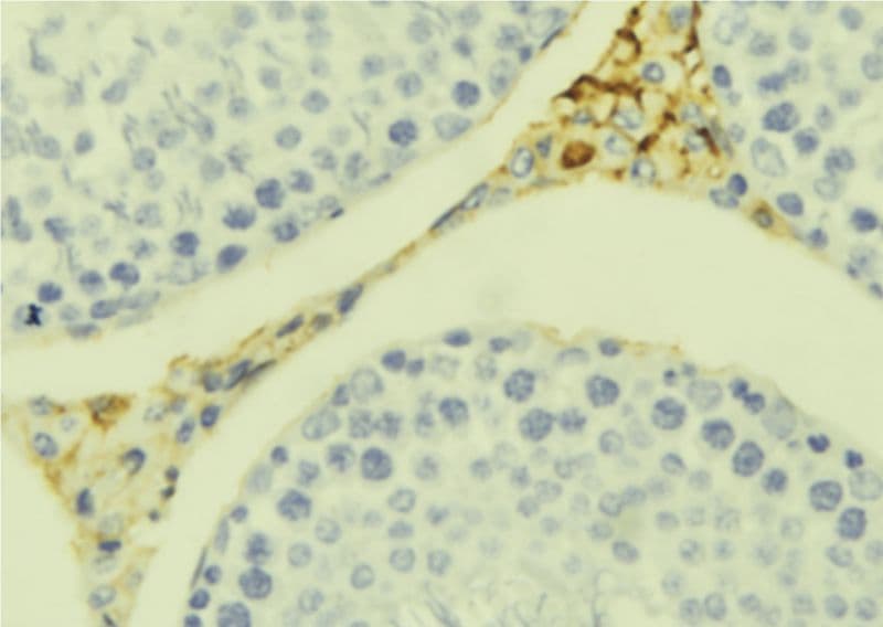 Polyclonal Rabbit anti-Human CCL20 / MIP-3-Alpha Antibody (IHC, WB)
