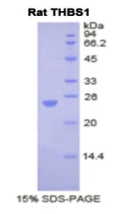 Rat THBS1 / Thrombospondin-1 Protein (Recombinant His)