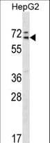 MED26 / CRSP7 Antibody (aa191-220)