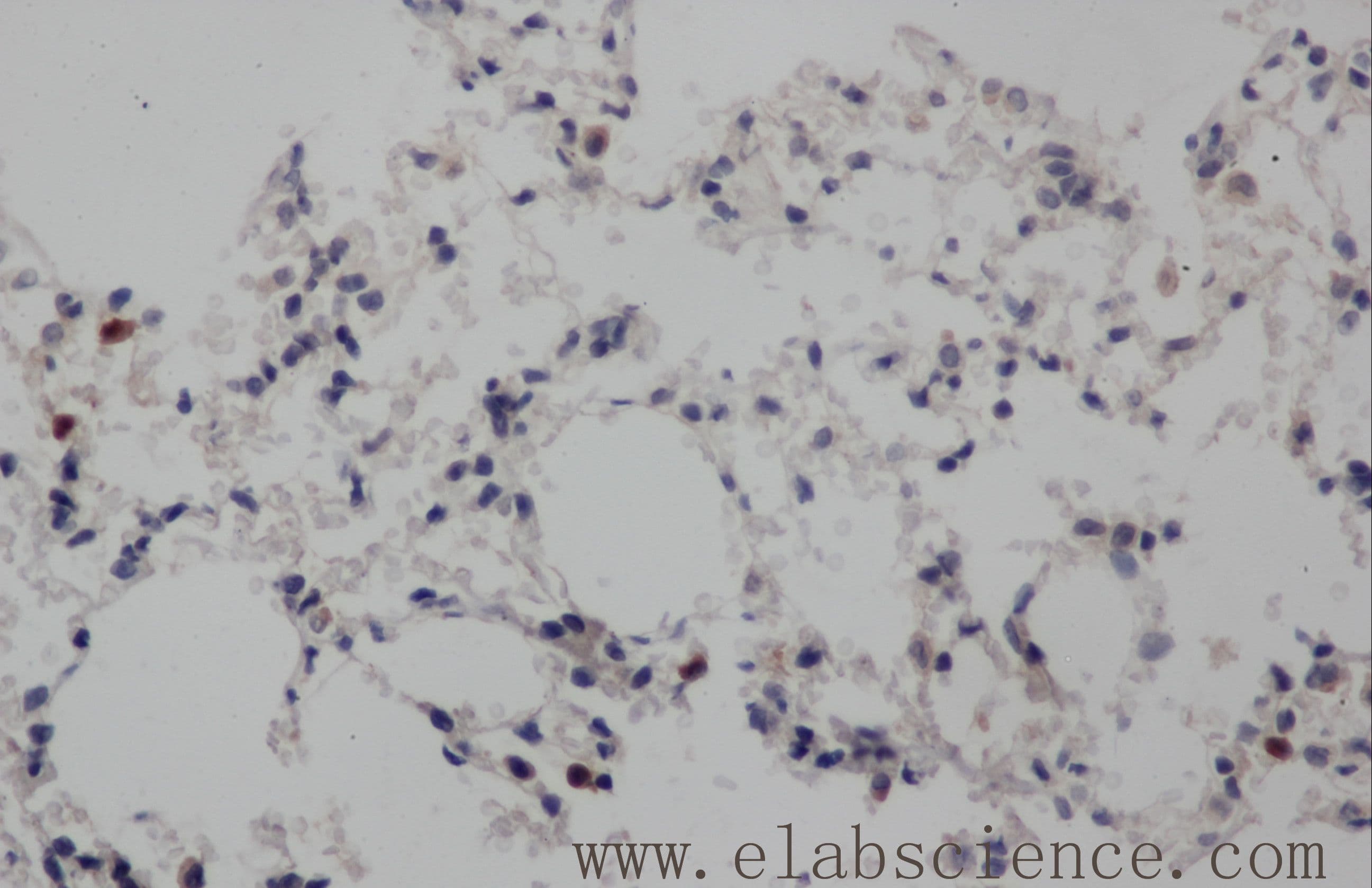 Polyclonal Rabbit anti-Human NOTCH1 Antibody (IHC, WB)