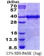 Human Myozenin / MYOZ1 Protein (Recombinant His)