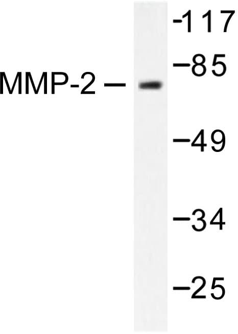 MMP2 Antibody (Leu638)