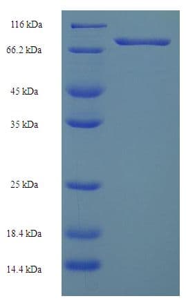 Human HSPBAP1 Protein (Recombinant His-SUMO)