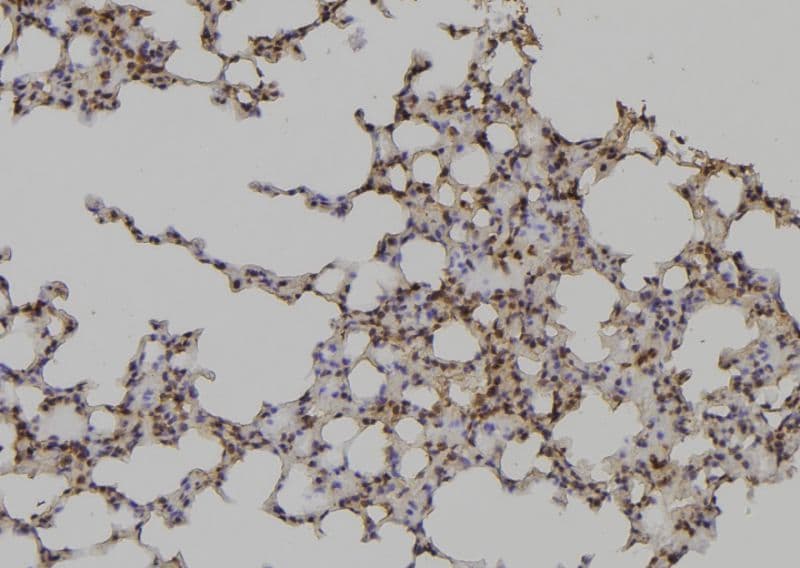 Polyclonal Rabbit anti-Human DLC1 Antibody (IHC, IF, WB)