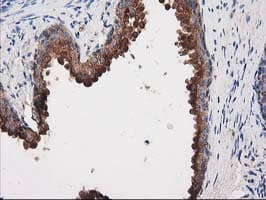 PRKAR2A Antibody (clone OTI1F8)