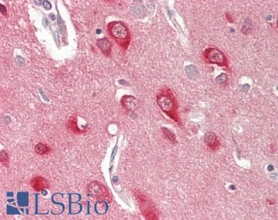 NRGN / Neurogranin Antibody (aa6-55, FITC)