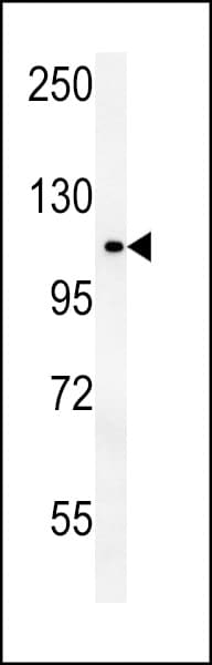 Polyclonal Rabbit anti-Human OTUD4 Antibody (aa403-430, IHC, WB)