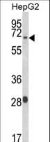 WAC Antibody (aa284-313)