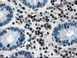 Monoclonal Mouse anti-Human APOM / Apolipoprotein M Antibody (clone OTI3H3, IHC, WB)