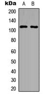 PPP4R1 / PP4R1 Antibody (Internal)