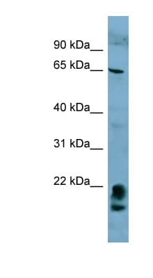 Polyclonal Rabbit anti-Human FAM134A Antibody (aa143-192, WB)
