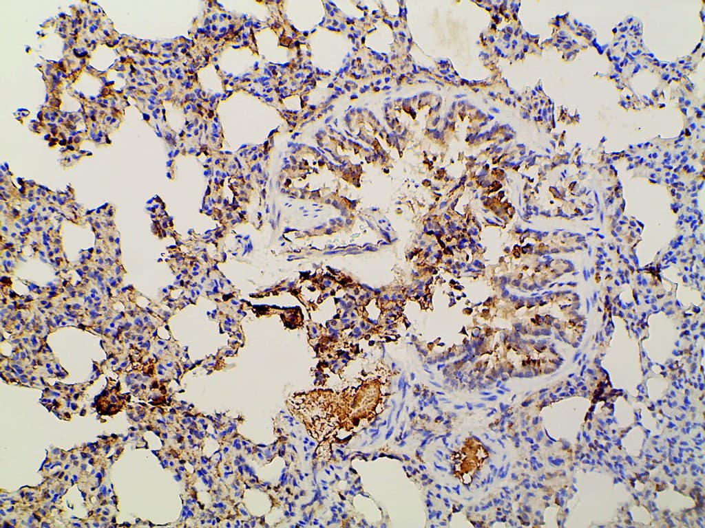 PIK3R1 / p85 Alpha Antibody (phospho-Tyr607)