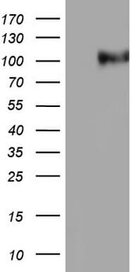 Monoclonal Mouse anti-Human NCAM / CD56 Antibody (clone OTI7D11, Carrier-free, aa20-718, WB)