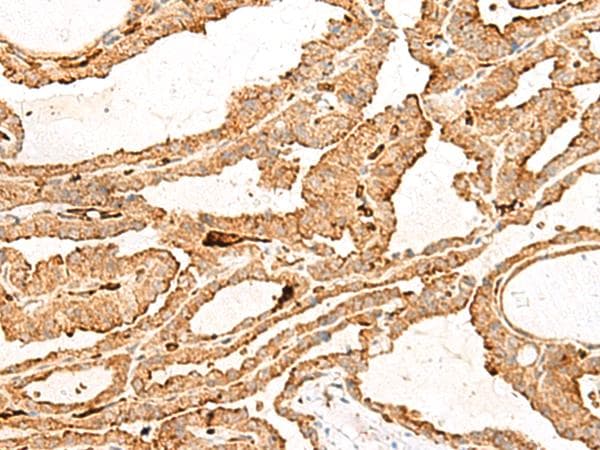 Hemoglobin Gamma (HBG1 + HBG2) Antibody