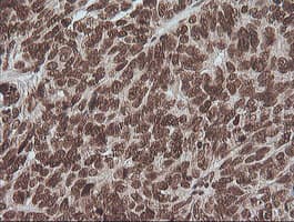 Monoclonal Mouse anti-Human MAPK3 / ERK1 Antibody (clone OTI4D7, IHC, IF, WB)