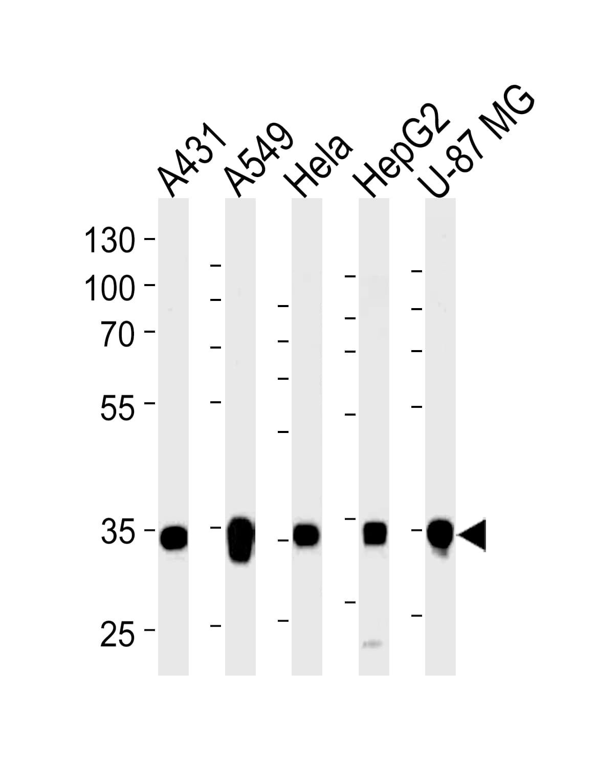 MDH / MDH2 Antibody (aa297-326)