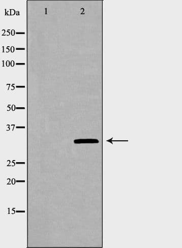 SULT1A1 / Sulfotransferase 1A1 Antibody
