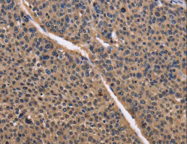 Polyclonal Rabbit anti-Human IDH1 / IDH Antibody (IHC, WB)