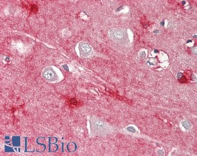 IHC-plus™ NPC / NPC1 Antibody (clone 4H2)