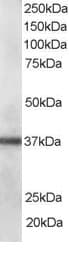 IHC-plus™ PDLIM1 Antibody (aa316-329)