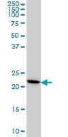 IHC-plus™ Monoclonal Mouse anti-Human RPS7 / Ribosomal Protein S7 Antibody (clone 3G4, IHC, IF, WB)