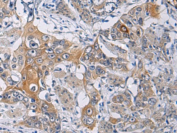 KCNJ10 / SESAME / KIR4.1 Antibody