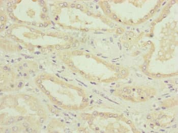 NDUFA12 / B17.2 Antibody
