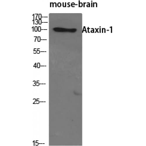 ATXN1 / SCA1 Antibody (720-800 aa)