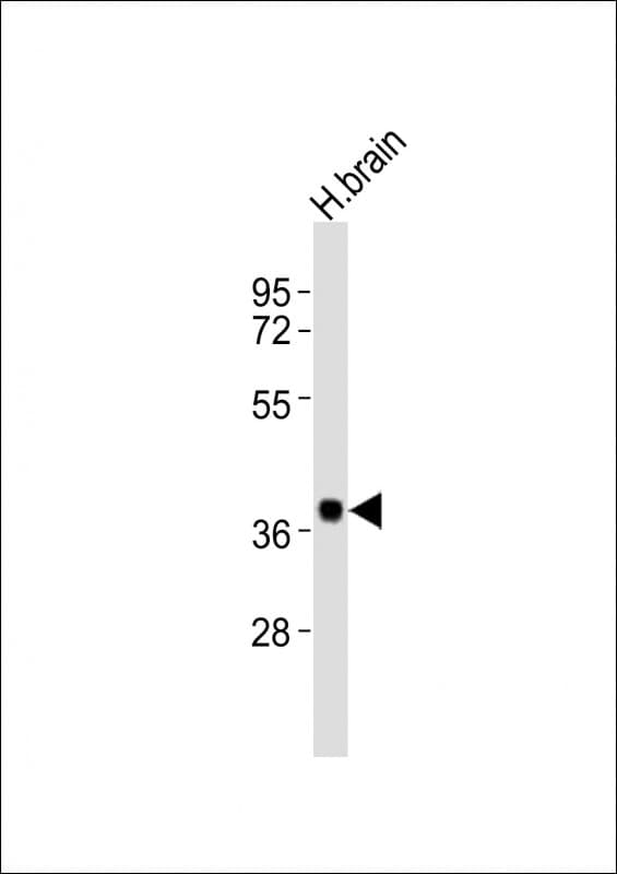 SH3GL3 Antibody (aa250-282)