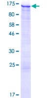 Human HIP1R Protein (Recombinant GST)