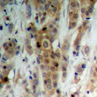 AKT1 + AKT2 + AKT3 Antibody (phospho-Ser246)