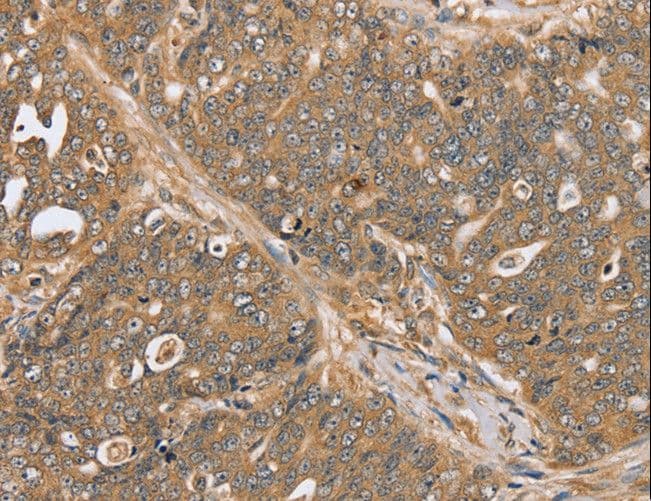 Polyclonal Rabbit anti-Human PTPN20 Antibody (IHC, WB)