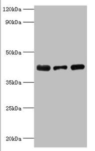 ST8SIA2 / STX Antibody (aa24-160)
